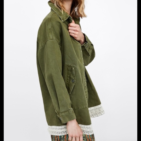 Zara Mixed Lace Overshirt - Picture 3 of 9